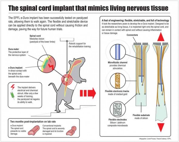 spinal-chord-implant-2
